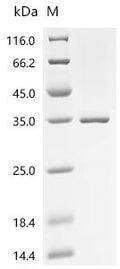 (Tris-Glycine gel) Discontinuous SDS-PAGE (reduced) with 5% enrichment gel and 15% separation gel.