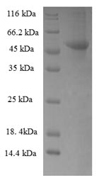 Recombinant Human Ribokinase (RBKS), partial – Figure 1 of 1