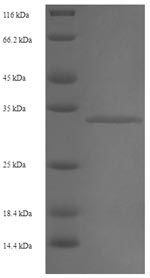 Recombinant Human Putative RNA-binding protein 3 (RBM3) – Figure 1 of 1