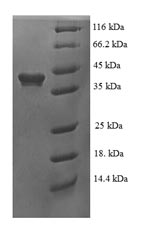 Recombinant Human RNA binding protein fox-1 homolog 2 (RBFOX2) – Figure 1 of 1