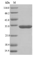 (Tris-Glycine gel) Discontinuous SDS-PAGE (reduced) with 5% enrichment gel and 15% separation gel.