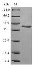 (Tris-Glycine gel) Discontinuous SDS-PAGE (reduced) with 5% enrichment gel and 15% separation gel.
