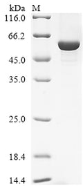 Recombinant Bovine Retinol-binding protein 3 (RBP3), partial – Figure 1 of 1
