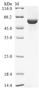 Recombinant Bovine Retinol-binding protein 3 (RBP3), partial – Figure 1 of 1