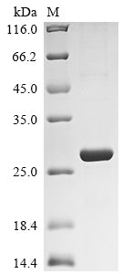(Tris-Glycine gel) Discontinuous SDS-PAGE (reduced) with 5% enrichment gel and 15% separation gel.