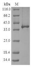 (Tris-Glycine gel) Discontinuous SDS-PAGE (reduced) with 5% enrichment gel and 15% separation gel.