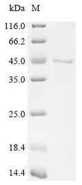 (Tris-Glycine gel) Discontinuous SDS-PAGE (reduced) with 5% enrichment gel and 15% separation gel.
