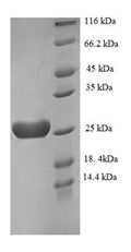 Recombinant Human Recoverin (RCVRN) – Figure 1 of 1