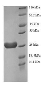 Recombinant Human Recoverin (RCVRN) – Figure 1 of 1