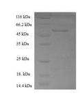 Recombinant human Retinol dehydrogenase 11 (RDH11), partial – Figure 1 of 1