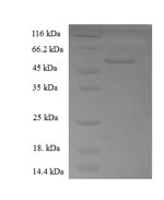 Recombinant human Retinol dehydrogenase 11 (RDH11), partial – Figure 1 of 1