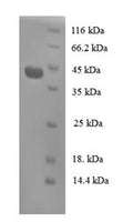 Recombinant Human Regenerating islet-derived protein 3-alpha (REG3A) – Figure 1 of 1