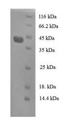 Recombinant Human Regenerating islet-derived protein 3-alpha (REG3A) – Figure 1 of 1