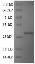 Recombinant Human Reelin (RELN), partial – Figure 1 of 1