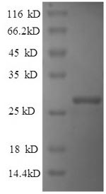 Recombinant Human Reelin (RELN), partial – Figure 1 of 1