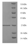 Recombinant Human Resistin (RETN) – Figure 1 of 1