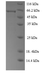 Recombinant Human Regulator of G-protein signaling 7 (RGS7) – Figure 1 of 1