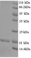 Recombinant Human Rhomboid-related protein 2 (RHBDL2), partial – Figure 1 of 1