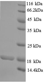 Recombinant Human Rhomboid-related protein 2 (RHBDL2), partial – Figure 1 of 1
