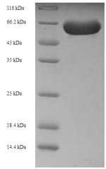 Recombinant Human Receptor-interacting serine/threonine-protein kinase 2 (RIPK2) – Figure 1 of 1