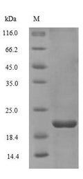 Recombinant Human Non-secretory ribonuclease (RNASE2) – Figure 1 of 1