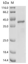 (Tris-Glycine gel) Discontinuous SDS-PAGE (reduced) with 5% enrichment gel and 15% separation gel.