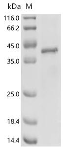 (Tris-Glycine gel) Discontinuous SDS-PAGE (reduced) with 5% enrichment gel and 15% separation gel.