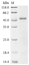 (Tris-Glycine gel) Discontinuous SDS-PAGE (reduced) with 5% enrichment gel and 15% separation gel.