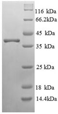 Recombinant Human RING-box protein 2 (RNF7) – Figure 1 of 1
