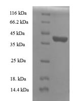 Recombinant Human Ropporin-1B (ROPN1B), partial – Figure 1 of 1