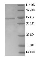 Recombinant Human Inactive tyrosine-protein kinase transmembrane receptor ROR1 (ROR1), partial – Figure 1 of 1