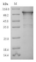 Recombinant Human Replication protein A 70kDa DNA-binding subunit (RPA1) – Figure 1 of 1