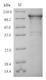 Recombinant Human Replication protein A 70kDa DNA-binding subunit (RPA1) – Figure 1 of 1