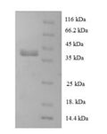 Recombinant Human 60S ribosomal protein L28 (RPL28) – Figure 1 of 1