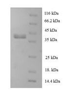 Recombinant Human 60S ribosomal protein L28 (RPL28) – Figure 1 of 1