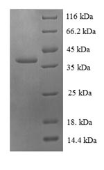 Recombinant Human 60S ribosomal protein L30 (RPL30) – Figure 1 of 1