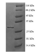 Recombinant Human 60S ribosomal protein L35a (RPL35A) – Figure 1 of 1