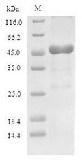 Recombinant Human 60S acidic ribosomal protein P0 (RPLP0) – Figure 1 of 1