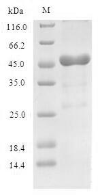 Recombinant Human 60S acidic ribosomal protein P0 (RPLP0) – Figure 1 of 1