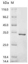 (Tris-Glycine gel) Discontinuous SDS-PAGE (reduced) with 5% enrichment gel and 15% separation gel.