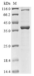 (Tris-Glycine gel) Discontinuous SDS-PAGE (reduced) with 5% enrichment gel and 15% separation gel.