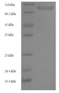 Recombinant Human Ribonucleoside-diphosphate reductase large subunit (RRM1) – Figure 1 of 1