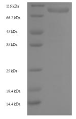 Recombinant Human Ribonucleoside-diphosphate reductase large subunit (RRM1) – Figure 1 of 1