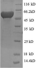 Recombinant Human Ribonucleoside-diphosphate reductase subunit M2 (RRM2) – Figure 1 of 1