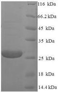 (Tris-Glycine gel) Discontinuous SDS-PAGE (reduced) with 5% enrichment gel and 15% separation gel.