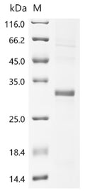 (Tris-Glycine gel) Discontinuous SDS-PAGE (reduced) with 5% enrichment gel and 15% separation gel.