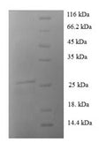 Recombinant Human Protein S100-A1 (S100A1) – Figure 1 of 1
