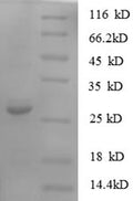 Recombinant Human Protein S100-A11 (S100A11) – Figure 1 of 1