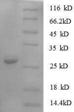 Recombinant Human Protein S100-A11 (S100A11) – Figure 1 of 1