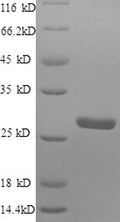 Recombinant Human Protein S100-A4 (S100A4) – Figure 1 of 1